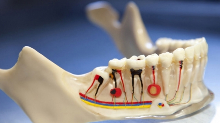 Endodonti (Kanal Tedavisi)