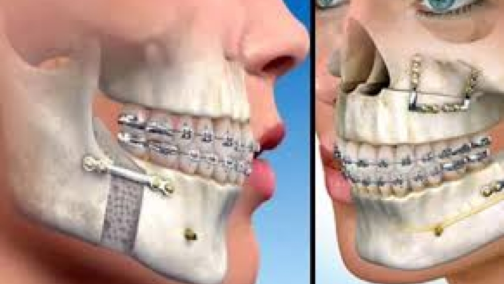 Ortodonti ile Tedavi Edilen Problemler