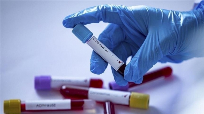 Türkiye 23.946 yeni koronavirüs vakası ve 290 ölüm daha bildirdi.
